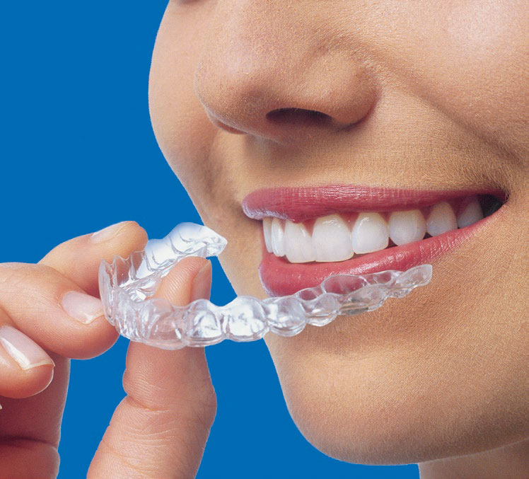 Invisalign Sonoma