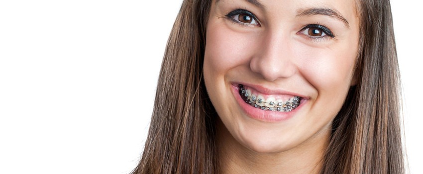 teen girl with braces