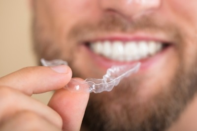 man with Invisalign